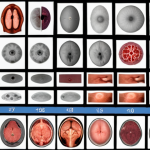 **Data Augmentation:** An image depicting a small dataset of blurry, low-resolution medical images being transformed into a larger, clearer dataset using data augmentation techniques. The augmented images showcase variations like rotations, crops, and slight color adjustments.  Show before-and-after examples highlighting the improvement in data quality. Include a faint background suggesting a medical research lab.